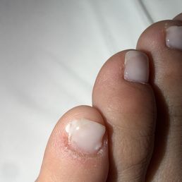 Pedicure