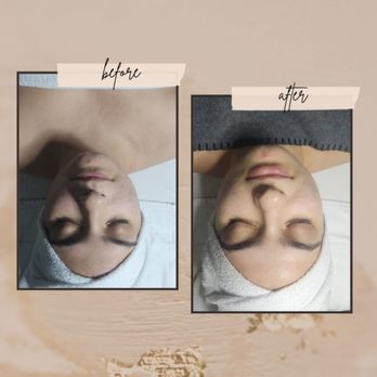 Skin by Dee - Classic Facial - Estheticians Near Me - Johnston, Rhode Island Skin by Dee - Classic Facial - Estheticians Near Me - Johnston, Rhode Island