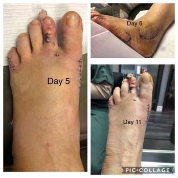 Liddy Podiatry & Prevention - Left foot. - Podiatrists Near Me - Beverly Hills, California Liddy Podiatry & Prevention - Left foot. - Podiatrists Near Me - Beverly Hills, California