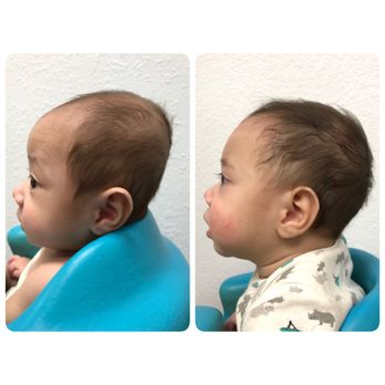 Why Do Babies Wear Those Helmets 2025 | m.aldourbano.com