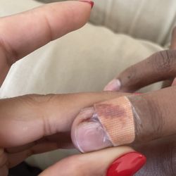 Nail Spree - Finger that is missing skin