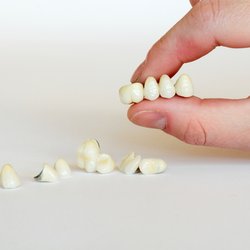 Stadium Family Dentistry of Ann Arbor - Dental Implants
