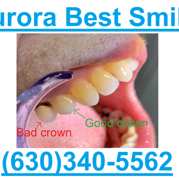 Aurora Best Smiles - General Dentistry Near Me - Aurora, Illinois Aurora Best Smiles - General Dentistry Near Me - Aurora, Illinois