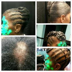 Silverlining Beauty and Hairloss Center - Hairloss /updo
