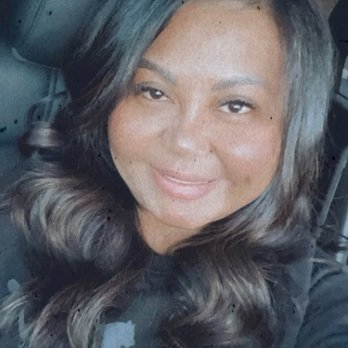 The Glow Method Skin Bar - Chin Lipo pic 2 months out - Skin Care Near Me - Tempe, Arizona