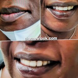 That New Look Skincare Specialist & Permanent Makeup Artist - Camouflage Lips