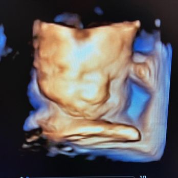 Maternal Love - Ultrasound Imaging Centers Near Me Maternal Love - Ultrasound Imaging Centers Near Me
