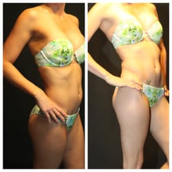 BronzFx - Before and After