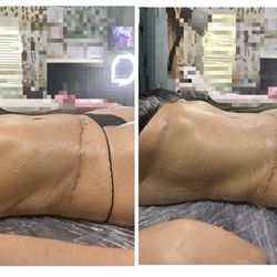 The Body Shop SFV - Ice sculpting with metal therapy