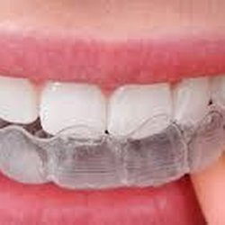 Xtreme Mouthguards - Need a RETAINER? Made while you wait