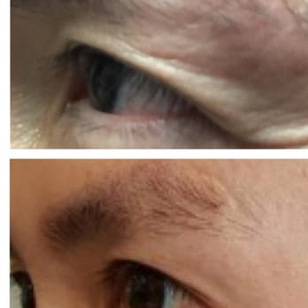 Joon Y Choi, MD - Botox done by Dr. Choi - Medical Spas Near Me - Orange, California Joon Y Choi, MD - Botox done by Dr. Choi - Medical Spas Near Me - Orange, California