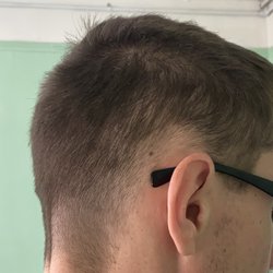 SmartStyle - What????