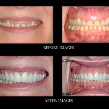 Leslie B. Anthony, DMD - General Dentistry Near Me - Kalispell, Montana