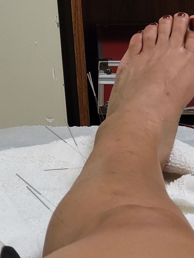 TLC CLOVE LAKE PHYSICAL THERAPY Updated October 2024 11 Photos 1428 Victory Blvd, Staten