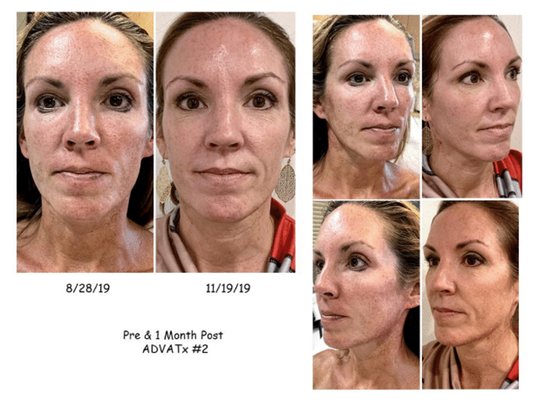 Bella Vie Med Spa Skin & Wellness Clinic