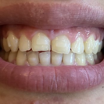 Encino Dental Studio-Amir Jamsheed, DDS - Suresmile progress - Cosmetic Dentists Near Me - Encino, California Encino Dental Studio-Amir Jamsheed, DDS - Suresmile progress - Cosmetic Dentists Near Me - Encino, California