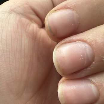 Pink Glam Nails & Spa - They don't even look done and I don't like complaining - Nail Salons Near Me - Hasbrouck Heights, New Jersey Pink Glam Nails & Spa - They don't even look done and I don't like complaining - Nail Salons Near Me - Hasbrouck Heights, New Jersey