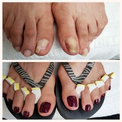 6ix Tips Nails & Spa - Look at this amazing transformation! Our goal is to make your hands and feet look beautiful to the best of our abilities. #happyfeet