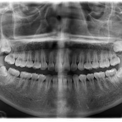 Dental Center Imaging - Panoramic