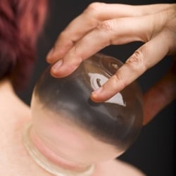 Renu Massage, Energy & Bodywork - Each of our therapists has been trained cupping therapy. We love it because it is so effective!
