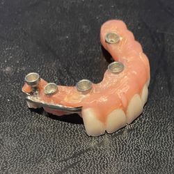 Vegas Choice Dental - This is how Peter Balle left me