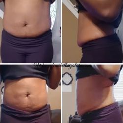 Body Rehab - 1 treatment / same day results