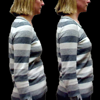 Arnie Wynn, DC - Look at these changes after just one visit. What a great change in their overall look and body posture - Chiropractors Near Me - Charlotte, North Carolina Arnie Wynn, DC - Look at these changes after just one visit. What a great change in their overall look and body posture - Chiropractors Near Me - Charlotte, North Carolina