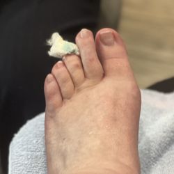 i Touch Day Spa - Toe that was bleeding