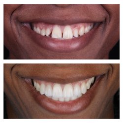 Center for Advanced Periodontal & Implant Therapy