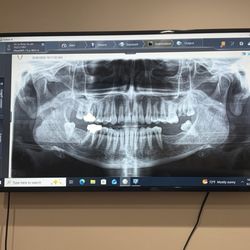Harjinder Singh, DDS - I was able to ask questions about my teeth and the doctor took his time to answer them for me.