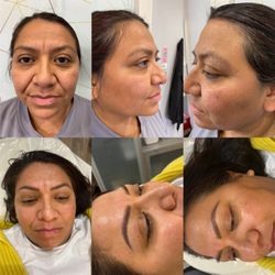 Saving Face - Before and after photos of ombre brow tattoo