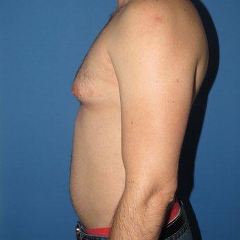 Babak Dadvand, MD - Cosmetic Surgeons Near Me - Beverly Hills, California