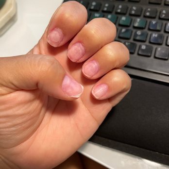 Highland Nails & Spa - After they removed the polish-- you could see how poorly shaped the nails were left - Nail Salons Near Me - Austin, Texas Highland Nails & Spa - After they removed the polish-- you could see how poorly shaped the nails were left - Nail Salons Near Me - Austin, Texas