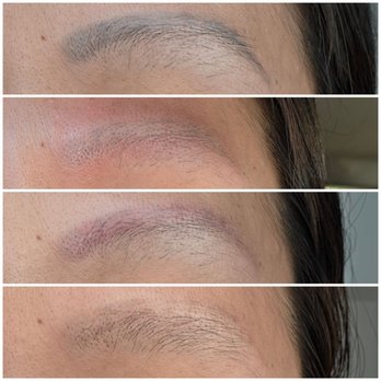 Mila Aesthetics - Before, immediately after, 1 wk after, 3 wks after. - Permanent Makeup Near Me - Las Vegas, Nevada Mila Aesthetics - Before, immediately after, 1 wk after, 3 wks after. - Permanent Makeup Near Me - Las Vegas, Nevada