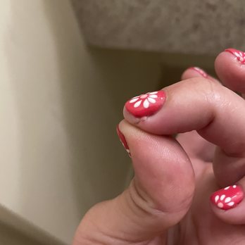 Le Nails - See dried blood and big swollen bump from cutting cuticles - Nail Salons Near Me - Los Angeles, California Le Nails - See dried blood and big swollen bump from cutting cuticles - Nail Salons Near Me - Los Angeles, California