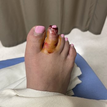 Circa - Laceration requiring stitches. - Casinos Near Me - Las Vegas, Nevada