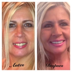 Shoker Devinder, DDS - What doctor Shoker did with my mom's teeth in less than one month