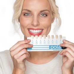 KITS Family Dental - Pola tooth whitening available at Kits Family Dental in Kitsilano, Vancouver
