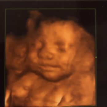 Baby Bump Studios - Loved this place, thank you for everything ! - Diagnostic Imaging Near Me - Ontario, California Baby Bump Studios - Loved this place, thank you for everything ! - Diagnostic Imaging Near Me - Ontario, California