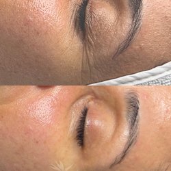 Bird of Paradise Skin Therapy - Oxygen treatments