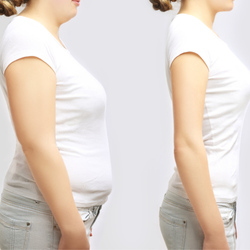 Just Lose Weight MD - medical weight looss