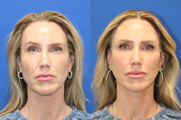 CARMEL VALLEY FACIAL PLASTIC SURGERY - Updated July 2025 - 135 Photos