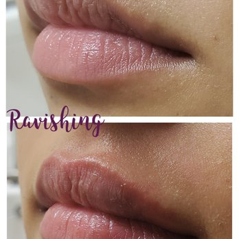 Ravishing - Skin Care Near Me - Gilbert, Arizona
