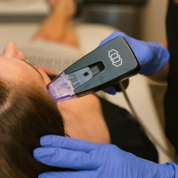 Omaha Med Spa - Morpheus 8 face treatment