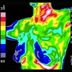 Clinical Thermography Associates - Note specific temperature range within image.