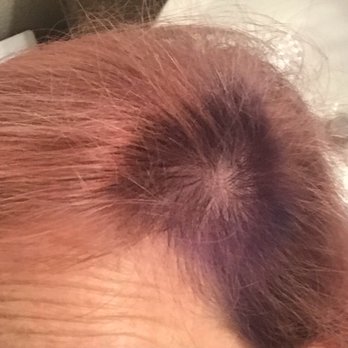 Ulta Beauty - How my stylist dealt with balding spot. Nice! - Cosmetics & Beauty Supply Near Me - Matthews, North Carolina Ulta Beauty - How my stylist dealt with balding spot. Nice! - Cosmetics & Beauty Supply Near Me - Matthews, North Carolina