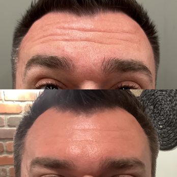 Longevity Aesthetics - Botox - Medical Spas Near Me - Rapid City, South Dakota