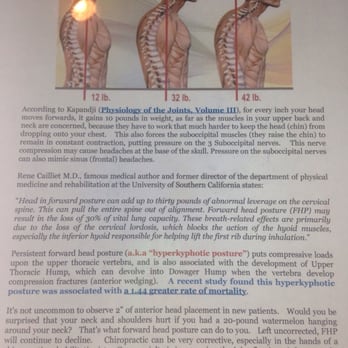 Brandon Takahashi, DC - What could happen - Chiropractors Near Me - Culver City, California Brandon Takahashi, DC - What could happen - Chiropractors Near Me - Culver City, California