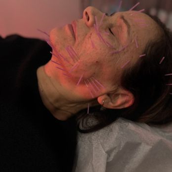 Choice Acupuncture - Acupuncture Near Me - Folsom, California