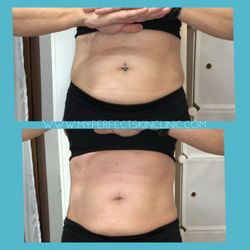 My Perfect Skin Clinic - Body Contouring
www.MyPerfectSkinClinic.com
Gilbert AZ